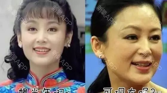 陈红与许晴,两个同龄女神如今差别巨大,袁立微博暗指有一个整形!