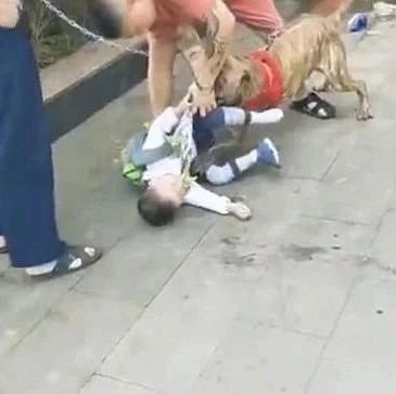 Boy, 4, attacked by a pit bull as passers-by fight the beast