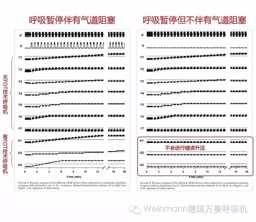 德国万曼呼吸机怎么样FOT强迫震荡技术_https://www.jmylbn.com_新闻资讯_第3张