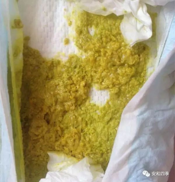 宝宝的大便