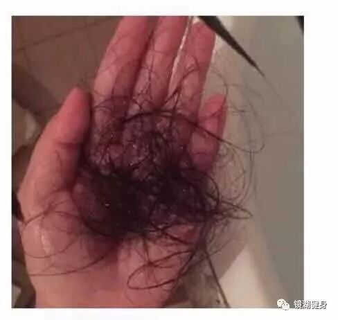 谣言粉碎机：英国水质硬导致脱发？