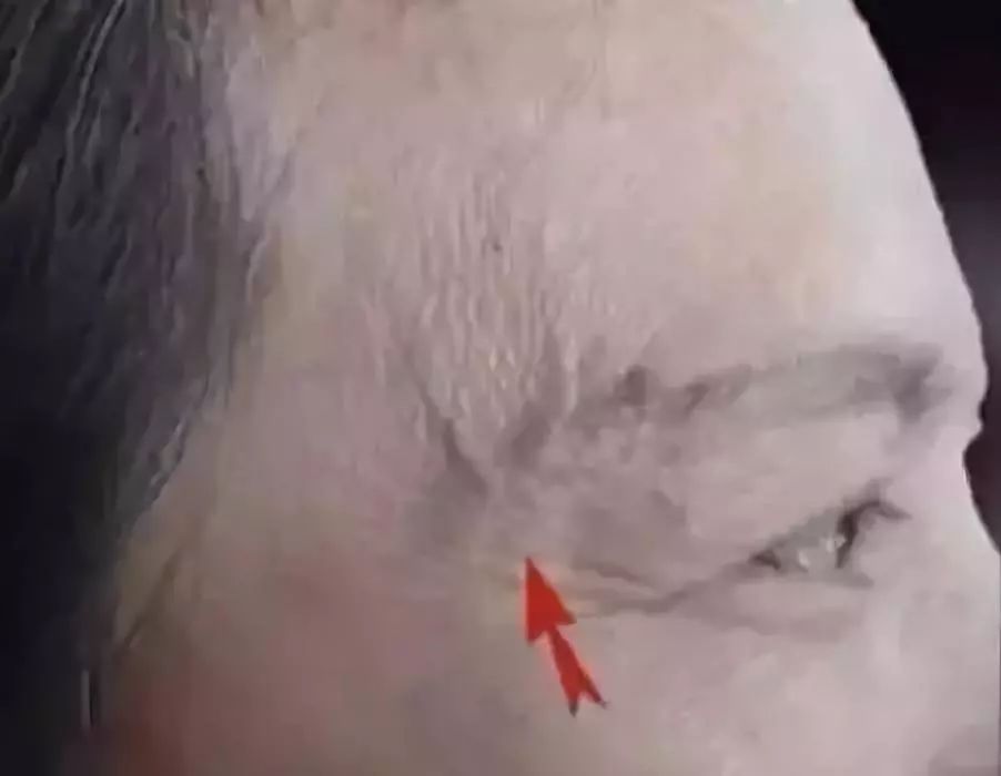 这个部位长青筋,非死即残!