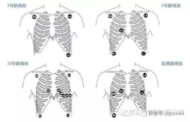 监护仪参数怎么看【干货收藏 】GE B40i病人监护仪操作、参数设置 、维护保养_https://www.jmylbn.com_新闻资讯_第4张