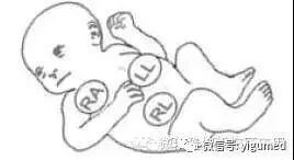 监护仪参数怎么看【干货收藏 】GE B40i病人监护仪操作、参数设置 、维护保养_https://www.jmylbn.com_新闻资讯_第6张