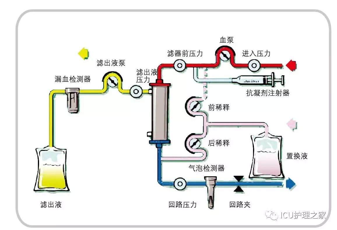 连续肾脏替代疗法crrt的那些事儿!