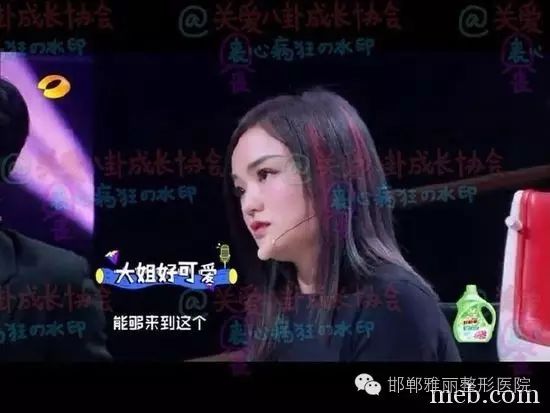 徐佳莹“被”整容 网友:被吓哭了!