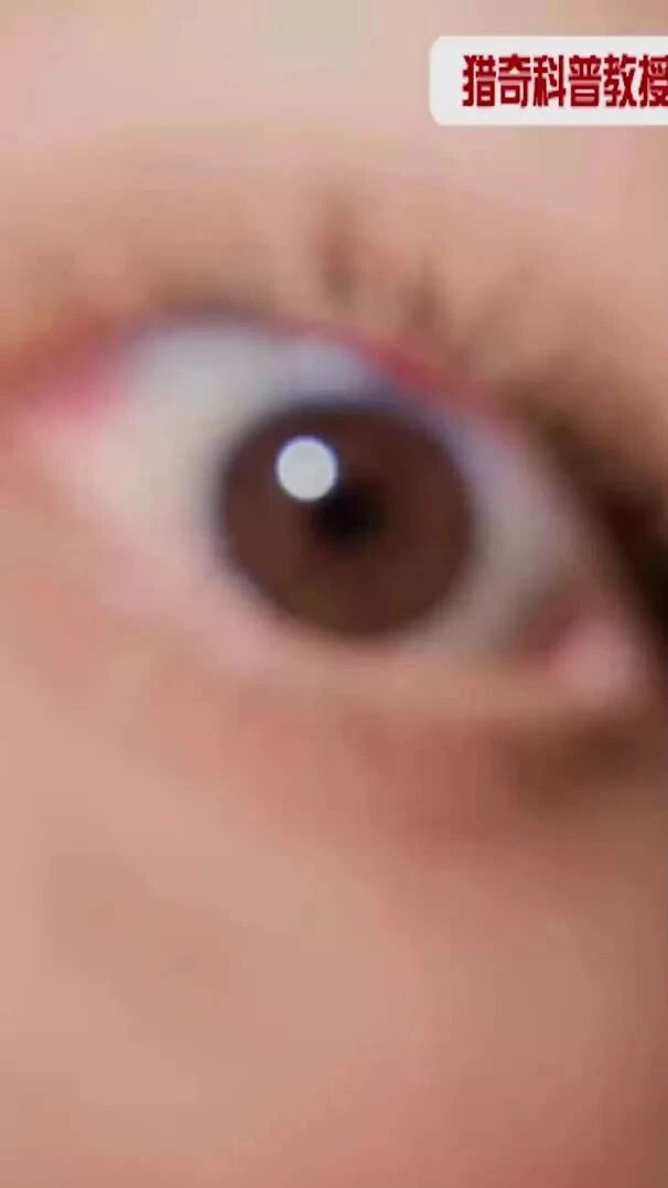 实拍 ▪ 超近距离看人眼像是另一个宇宙