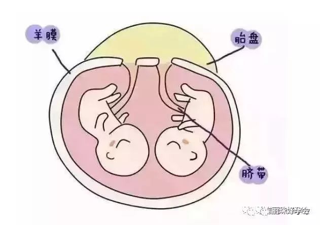 双胞胎到底是怎么形成的?正在备孕的你好奇吗?
