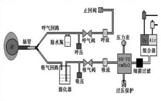 呼吸机是怎么给压力的从概念到原理：学习呼吸机从这篇文章开始_https://www.jmylbn.com_新闻资讯_第6张