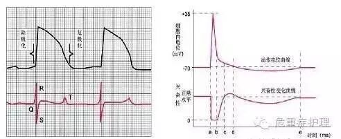为什么选择双相波心脏电复律你不知道的事_https://www.jmylbn.com_新闻资讯_第10张
