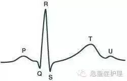 为什么选择双相波心脏电复律你不知道的事_https://www.jmylbn.com_新闻资讯_第5张