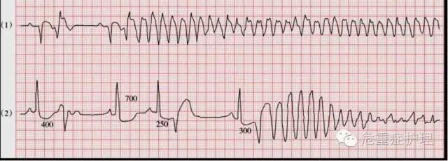 为什么选择双相波心脏电复律你不知道的事_https://www.jmylbn.com_新闻资讯_第7张