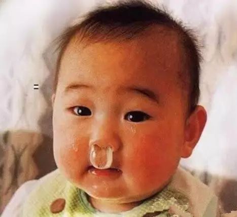 清水鼻涕or黄龙鼻涕，哪个证明感冒快好了？医生这样说…（附最新气象）