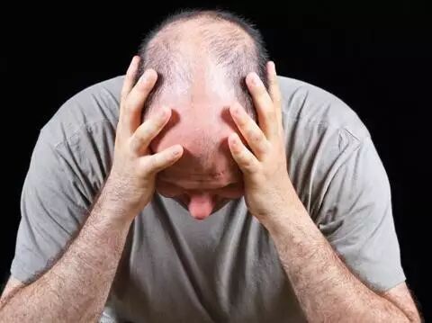 脂溢性脱发和斑秃怎么办？也许文章里有你想要的答案！