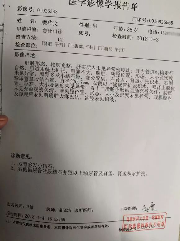 肾结石,胆结石喜欢的人群,你躺着中枪了吗?