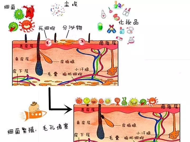 给你的皮肤一次定期"大扫除"