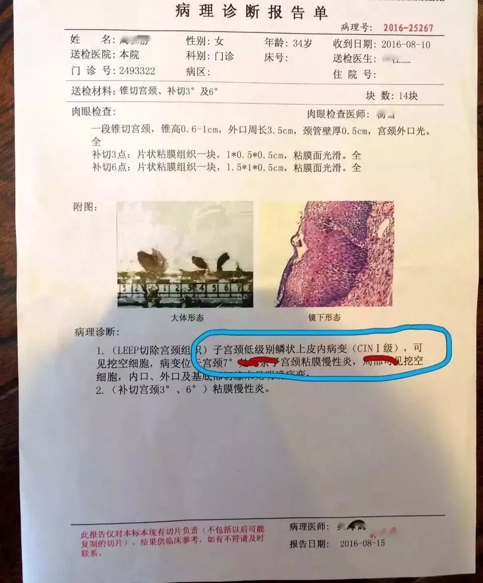 【案例】可治愈的妇科hpv( )