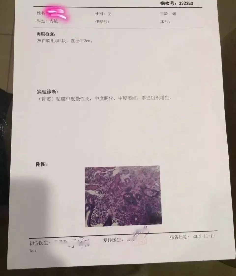 以下是另外一例肠上皮化生胃炎患者,近3年的胃镜和病理报告,前几天被