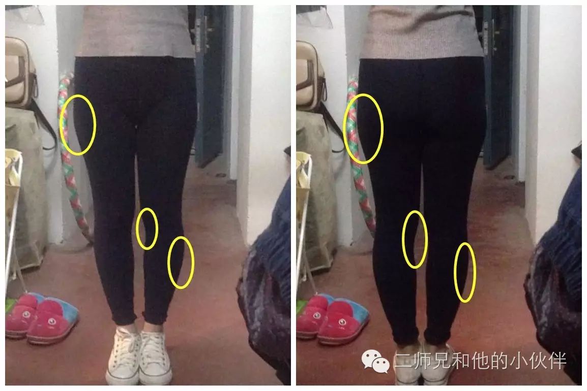 其实,这些最终的原因都是因为大腿内侧过于紧张,而臀部过于无力,而