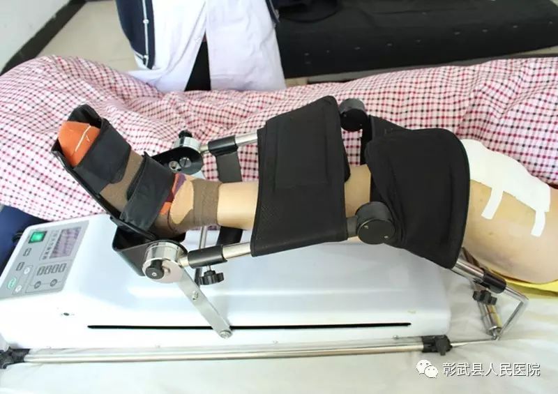 【科室展示】下肢关节康复器助力外二科双膝关节置换患者