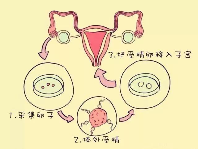 是否能怀双胞胎是需要根据子宫大小,子宫内膜各方面情况才能决定的