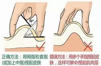 《梅奥医学期刊》最新胰岛素给药建议(三):人胰岛素、皮肤皱褶、混浊胰岛素再悬及怀孕相关内容-怀孕期