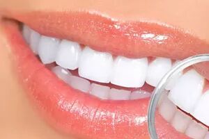 牙齿美白这么火，靠谱吗？