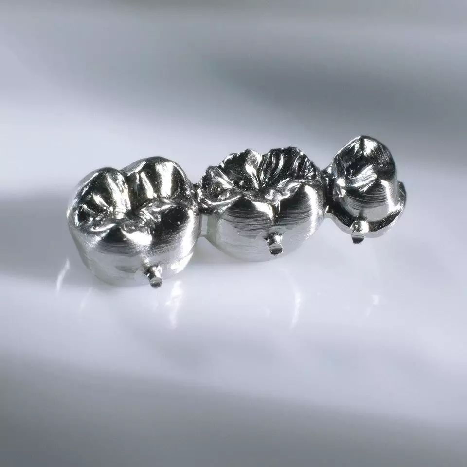 非贵金属烤瓷牙的种类分为镍铬合金烤瓷牙和钴铬