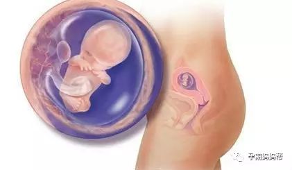 怀孕初期死胎的症状（妊娠最严重的并发症之一）