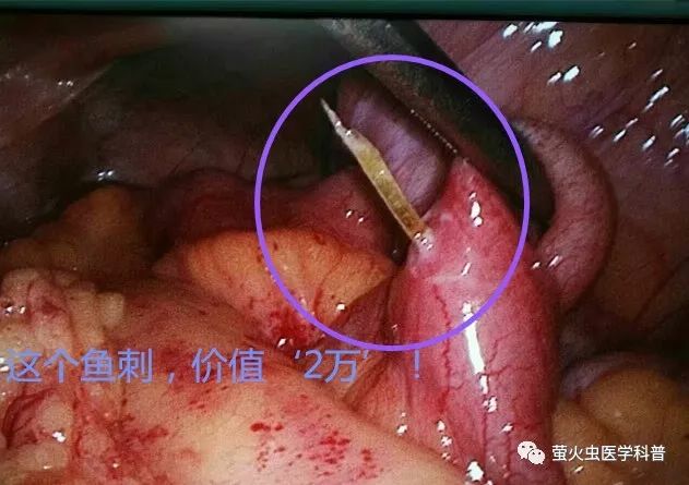 安全过年 ll 比鱼翅贵的鱼刺,价值过万,花钱且难受!