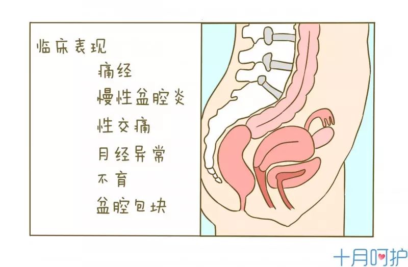 15种最常见妇科病的自查方法,掌握了可能会救你一命