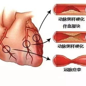 太珍贵了!心血管疾病图文详解--医学培训刘小峰