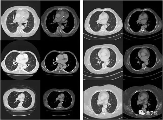 病人还能生存多久？现在AI能给出更精准的预测