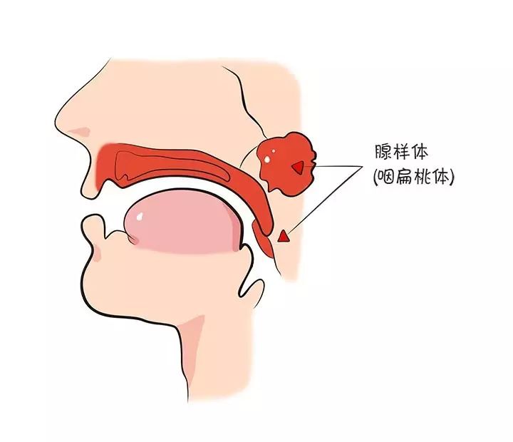 这个小伙伴也叫咽扁桃体,也是一个防御小能手,只是天性害羞,待在咽喉