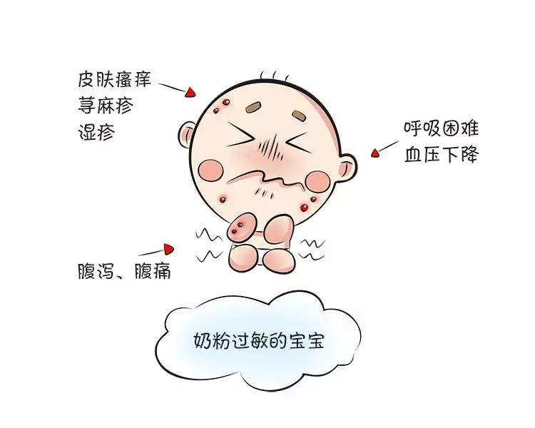 好端端的,宝宝怎么就奶粉过敏了呢?