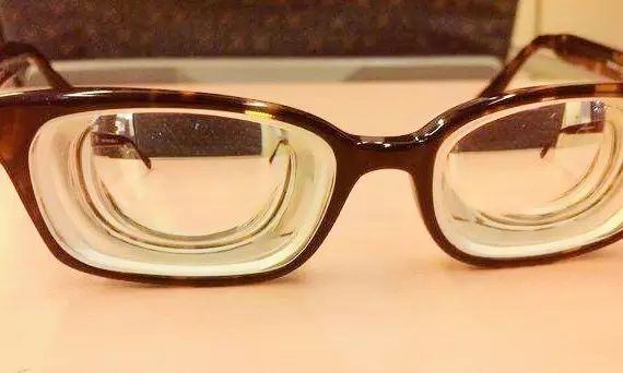 因为高度近视,必须戴上一副厚厚的眼镜.图片来源/tieba.baidu.