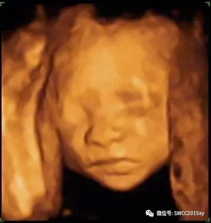 怀孕后咋会出现下腹部疼痛-怀孕期