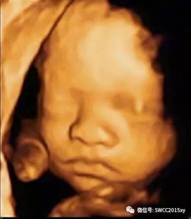 怀孕后咋会出现下腹部疼痛-怀孕期