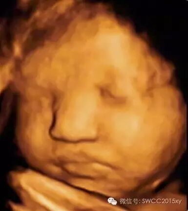 宫内有节育器咋还会怀孕,对胎儿有影响吗?-怀孕期