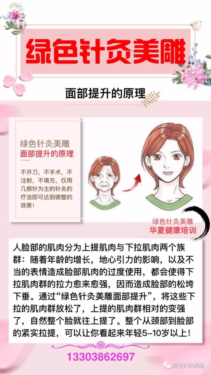 绿色针灸美雕美容减肥纯技术纯绿色疗法13303862697