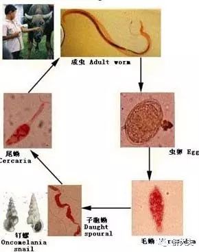 怎么预防血吸虫肝病呢