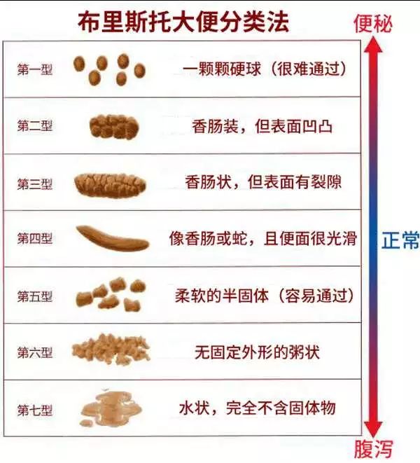 大便颜色竟能反映健康状况!现在对照看看自身健康还不晚!