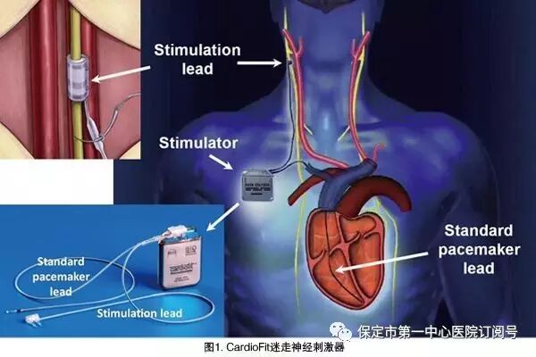 手術(shù)減肥_減肥手術(shù)多少錢_減肥手術(shù)哪種方式最好