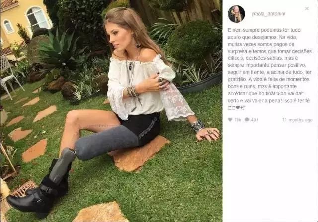 圈粉150万，这个23岁的巴西姑娘只用了一条腿 - 21