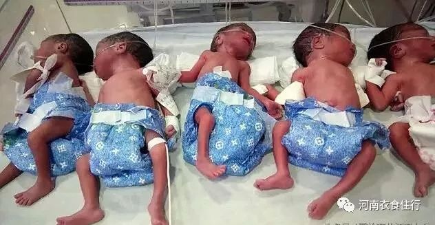 广东37岁二胎孕妈剖腹产下五胞胎,看到孩子性别,产科医生都笑了