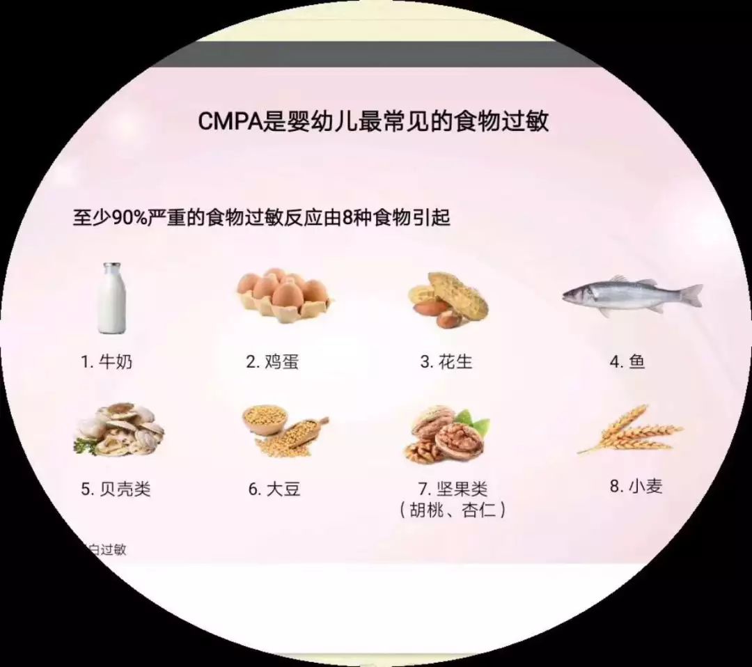 引起宝宝食物过敏的八大过敏源