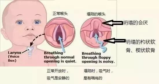 声带在说话,哭或呼吸时张开,在喝水或进食时关闭,从而保护吞咽时食物