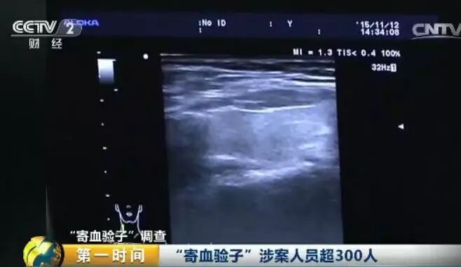 【震惊】全国最大＂寄血验子＂案告破,涉案超2亿!多为二胎孕妇…-怀孕期