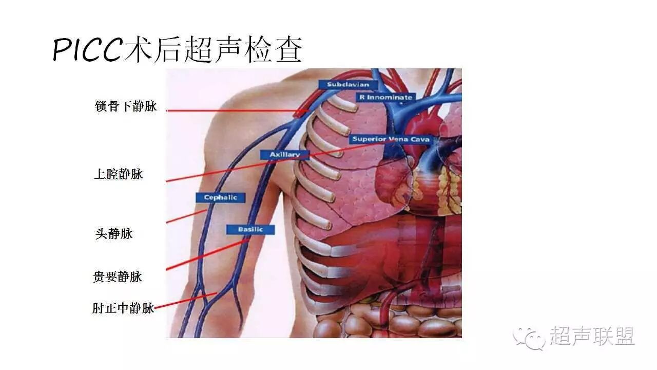 描述瘘口前后动,静脉血流方向.