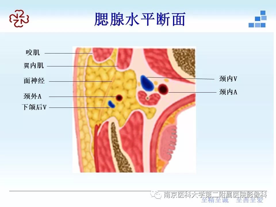 腮腺腺淋巴瘤的影像学表现